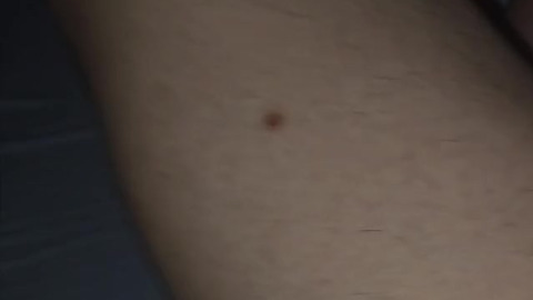 Bumbum guloso, ANAL